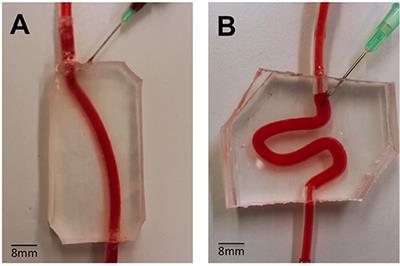 Physical Vein Models to Quantify the Flow Performance of Sclerosing Foams